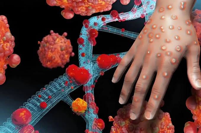 Madagascar enregistre plus de 2.600 cas confirmés de mpox depuis la détection du virus en décembre dernier