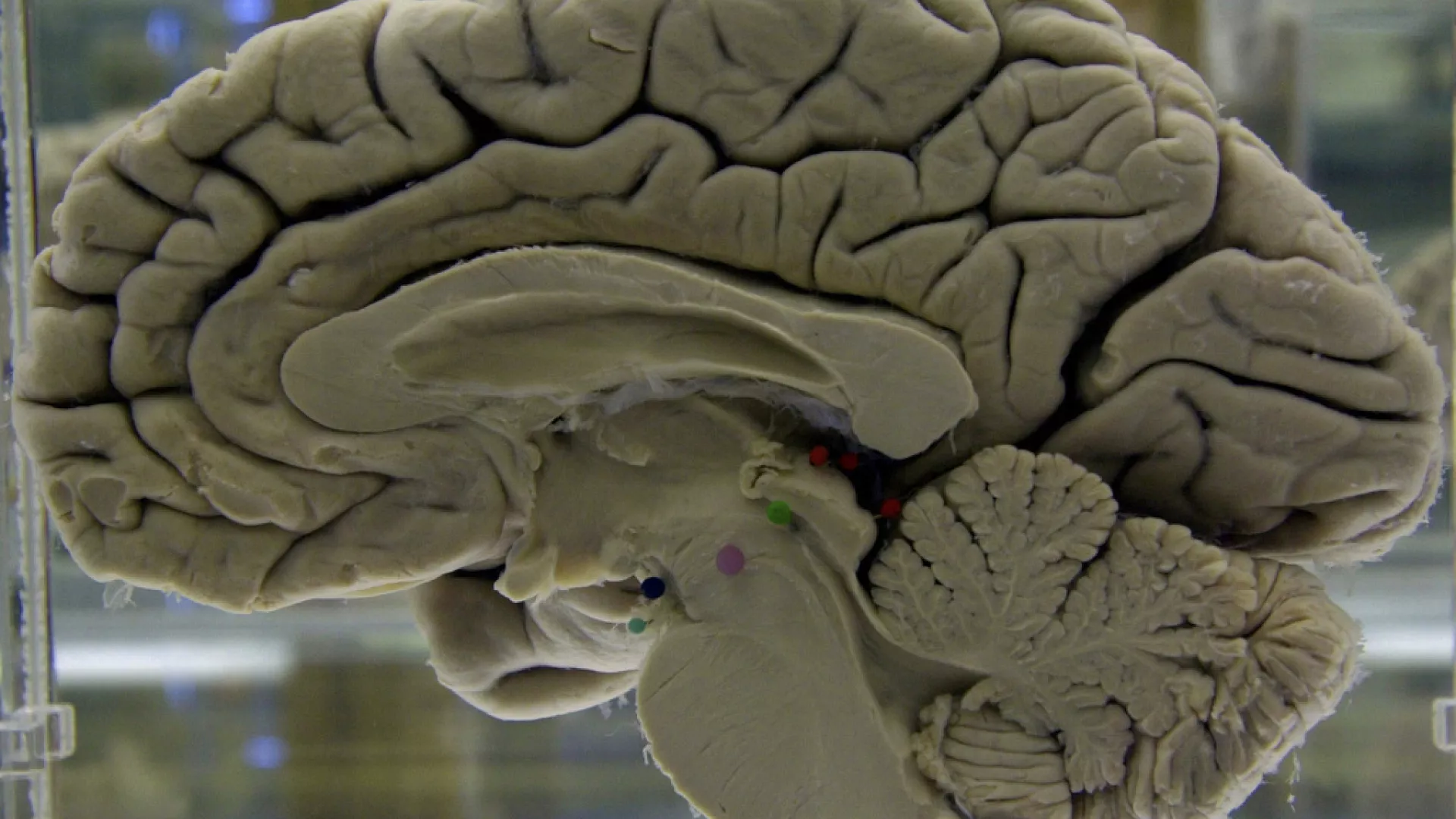 Le cerveau ne vieillit pas progressivement : sa détérioration commence plus tôt qu'on ne le pense et de manière soudaine