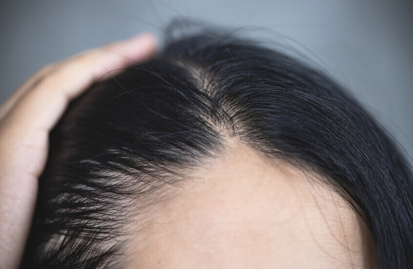 Une médecin révèle un ingrédient simple dans la cuisine qui traite les problèmes du cuir chevelu.